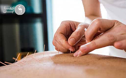 طب سوزنی برای درد عضلانی در شمال تهران؛ جلسه‌ی آرامش‌بخش با ماسور تیم ملی